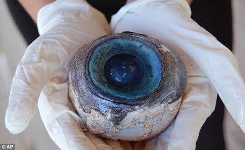 The Giant eyeball 