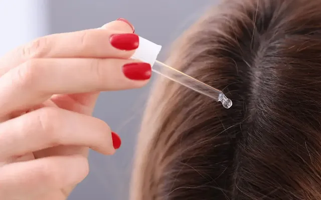 A medical treatment doing on hair