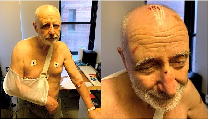 Buscan motoristas dieron paliza a hombre de 76 años por reclamarles alta velocidad y ruidos en parque del Alto Manhattan