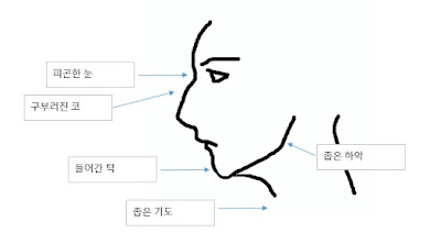 아데노이드형 얼굴