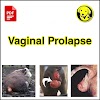 Free Download Vaginal Prolapse Full Pdf