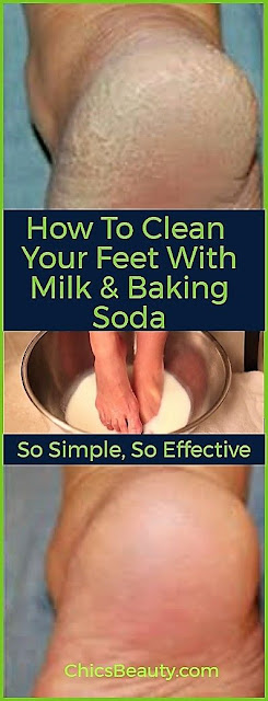 Simple And Effective: How to Heal Your Cracked Feet With Baking Soda