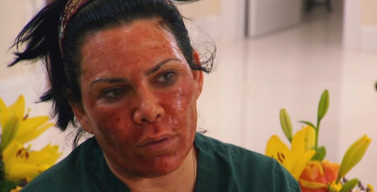 mob wives renee graziano ex husband. Renee Graziano during healing