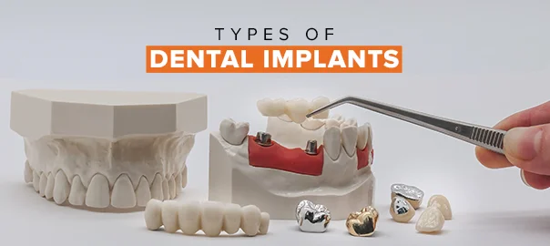 different types of dental implants and their uses