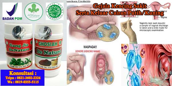 Kenapa Kencing sakit keluar cairan putih setelahnya