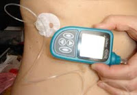 living with insulin pump therapy guidelines for successful outcomes