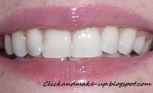 crest whitestrips  reveiw