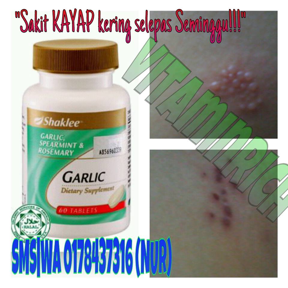 Kebaikan Garlic Complex Shaklee , Khasiat Bawang Putih 