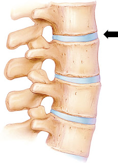 image of spinal disk