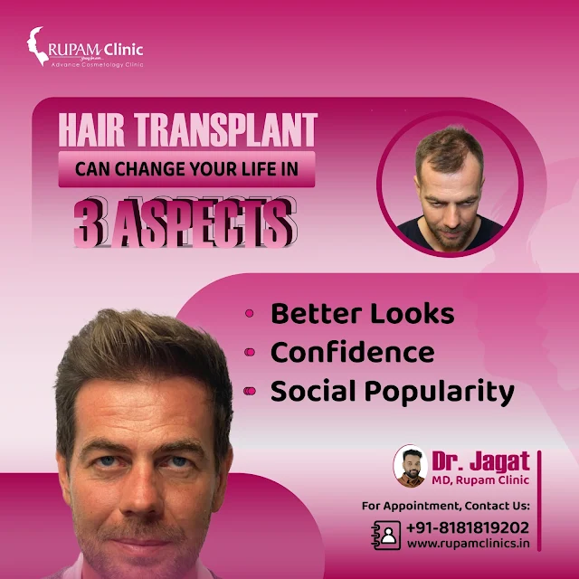 Hair Transplant Treatment