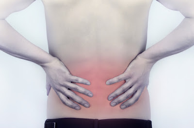 Tìm hiểu bệnh đau cơ lưng là gì?