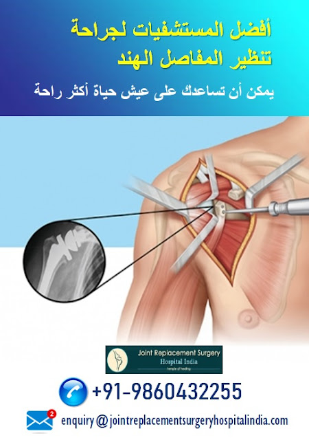 أفضل المستشفيات لجراحة تنظير المفاصل الهند