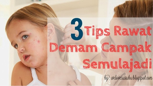 3 Tips Merawat Demam Campak Pada Anak Semulajadi 