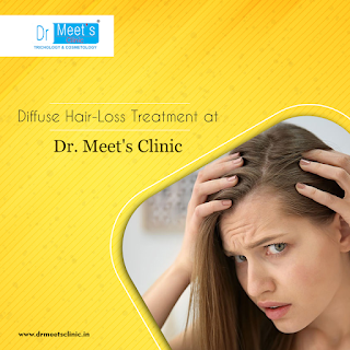 hair loss treatment in indore