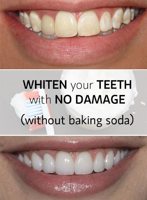 Whiten teeth fast and with no damage