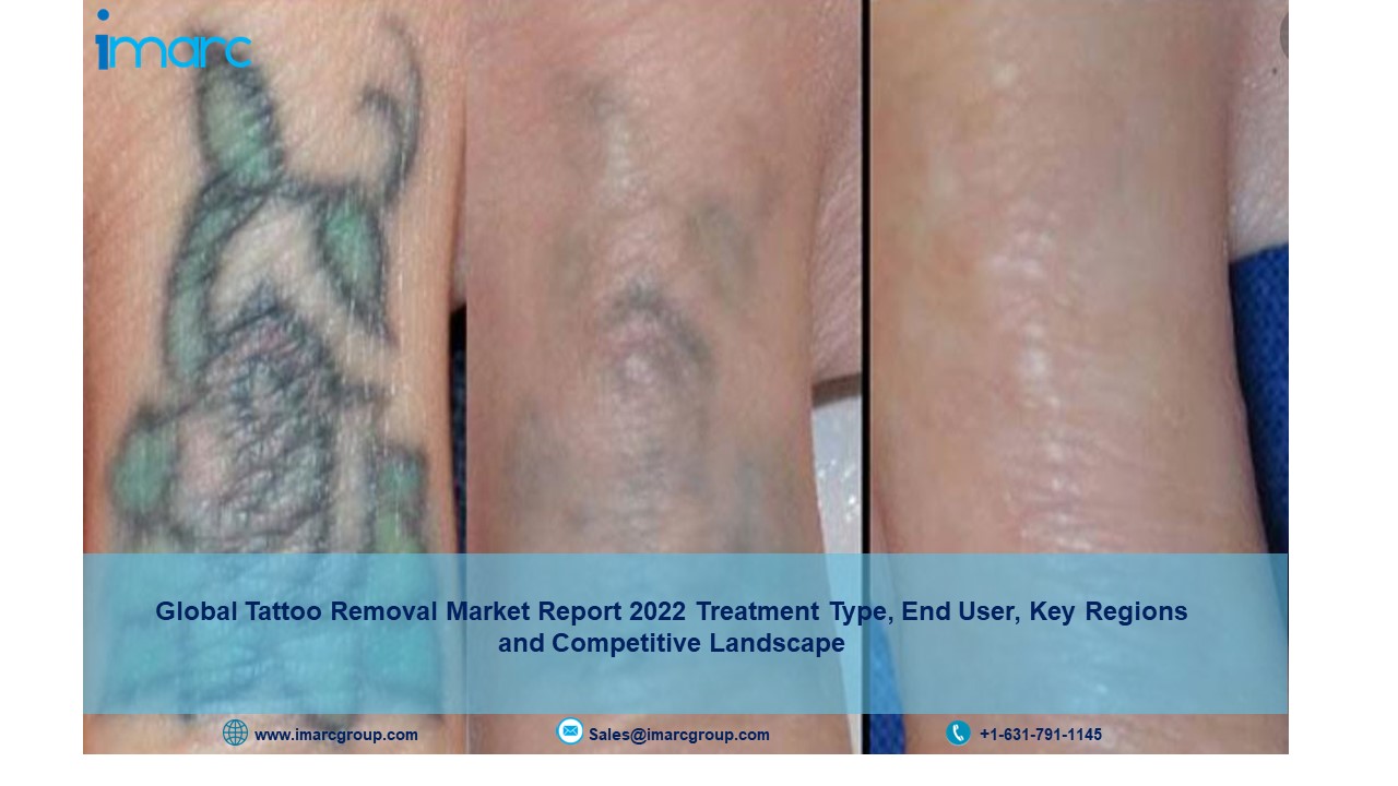 How Does Laser Tattoo Removal Work Pain Effectiveness Safety