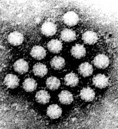 Health Tips: New Strain of Norovirus - the Winter Vomiting Bug - On the Rise