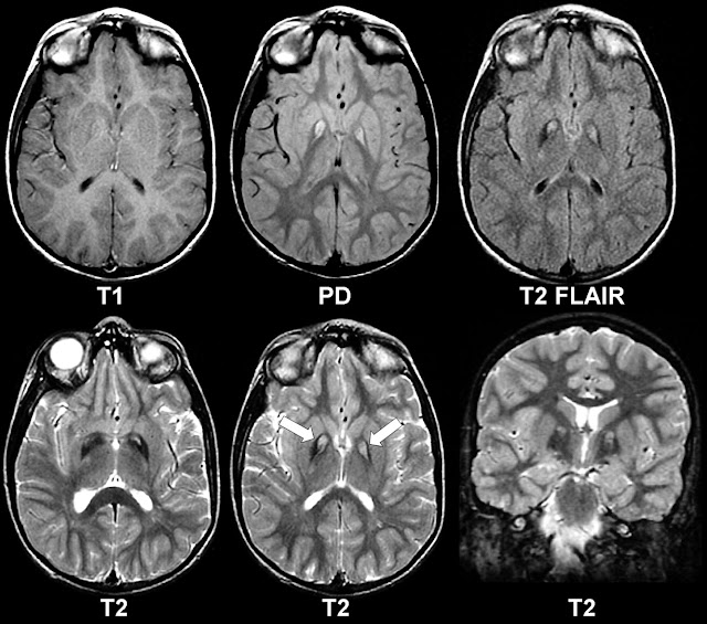 Brain Radiology4
