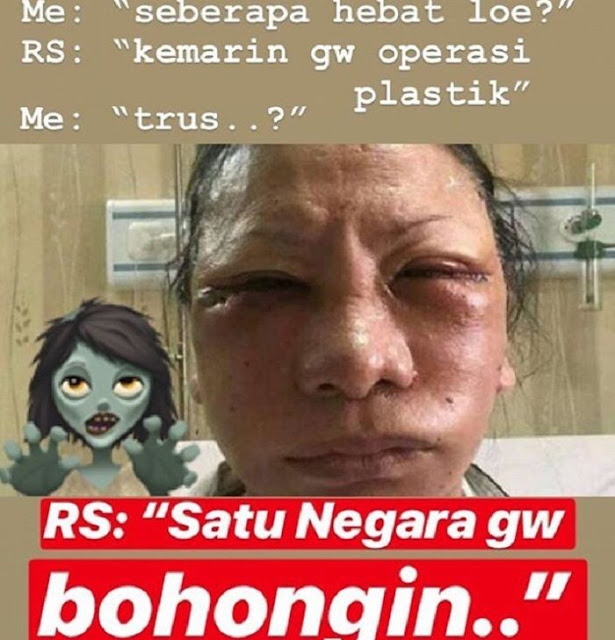 agen-poker-meme-lucu-ratna-sarumpaet