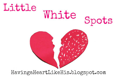 http://havingaheartlikehis.blogspot.com/2016/07/little-white-spots.html