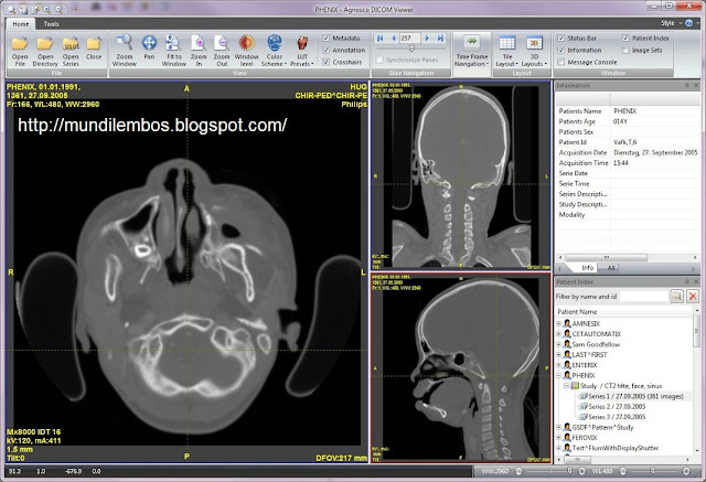 Free Download Agnosco DICOM Viewer 2.3.5.0 [LATEST] Full Version