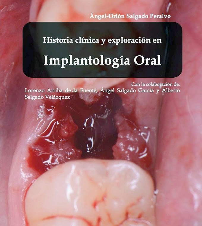 LIBRO: Historía clínica y exploración en Implantología Oral -  Dr. Angel-Orión Salgado