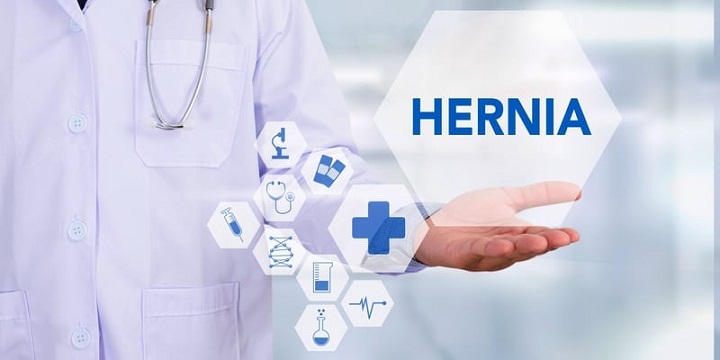 Mengenal Hernia atau Turun Berok, dan Memahami Gejalanya