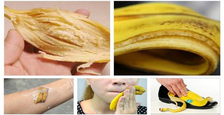 Stop Throwing The Banana Peels Away: Here Are 10 Ways To Use Them