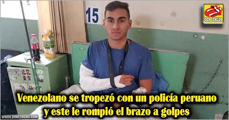 Venezolano se tropezó con un policía peruano y este le rompió el brazo a golpes