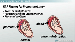 Preterm Birth Complications