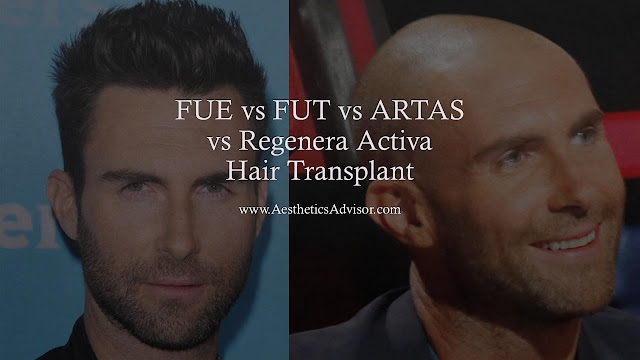 hair transplant singapore