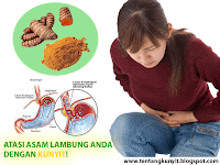 Sakit Maag akibat asam lambung obat herbalnya Kunyit Putih