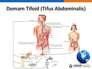 Penyakit Demam Tiroid