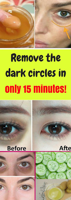 Remove the dark circles in only 15 minutes!