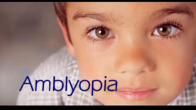 Obat Herbal Amblyopia