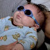 Pictures of a Baby Born with No Eyes(Pics)