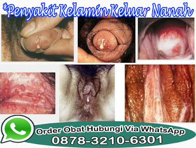 Obat Kencing Sakit Wanita