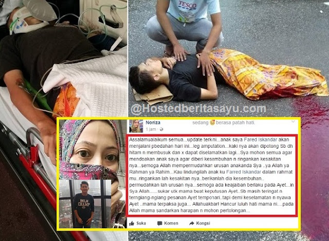 Kaki Fareed akan dipotong sebab dah hitam membusuk.. demi nyawa Fareed mama terpaksa (6 Gambar)