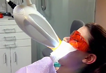 Trám răng laser tech có ưu điểm gì?