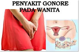 Vagina Gatal Dan Perih