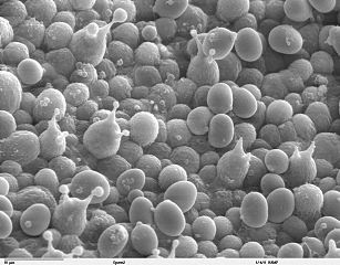 electron microscope image of budding mushroom spores