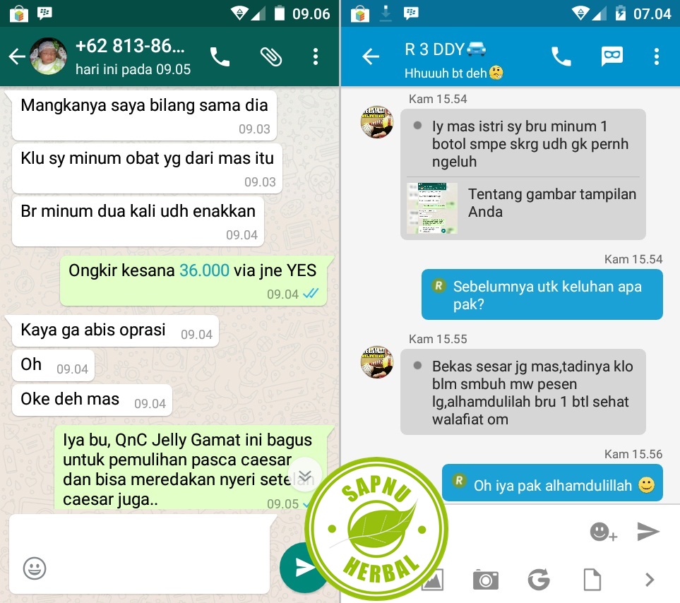 Cara Menyembuhkan Luka Jahitan yang Terbuka Dengan Obat 