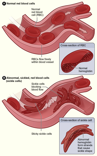 RS AWAL BROS MAKASSAR: Fungsi Sel Darah Merah di Tubuh Manusia