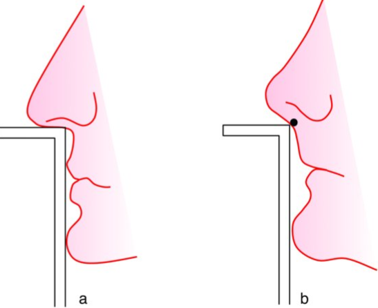 수평구순각