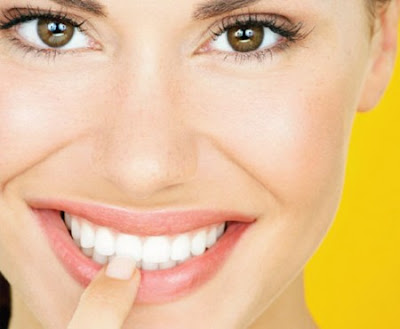 Tẩy trắng răng an toàn tại phòng nha như thế nào?