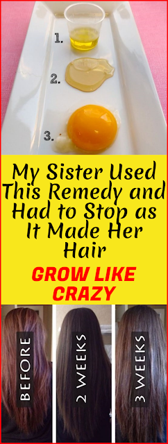 My Sister Used This Remedy And Had To Stop as it Made Her Hair Grow Like Crazy!