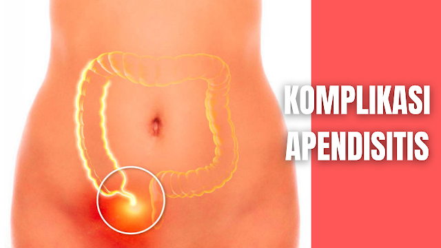 Komplikasi Apendisitis Pada Manusia Komplikasi yang terjadi pada apendisitis menurut Smeltzer dan Bare (2009). yaitu :  Perforasi Perforasi berupa massa yang terdiri dari kumpulan apendiks, sekum, dan letak usus halus. Perforasi terjadi 70% pada kasus dengan peningkatan suhu 39,50C tampak toksik, nyeri tekan seluruh perut dan leukositosis meningkat akibat perforasi dan pembentukan abses.    Peritonitis Peritonitis yaitu infeksi pada sistem vena porta ditandai dengan panas tinggi 390C – 400C menggigil dan ikterus merupakan penyakit yang jarang.    Nah itu dia bahasan dari komplikasi Apendisitis pada manusia, melalui bahasan di atas bisa diketahui mengenai komplikasi apendisitis pada manusia. Mungkin hanya itu yang bisa disampaikan di dalam artikel ini, mohon maaf bila terjadi kesalahan di dalam penulisan, dan terimakasih telah membaca artikel ini."God Bless and Protect Us"