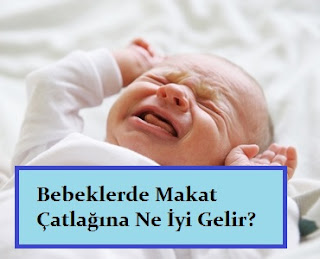 Bebeklerde Makat Çatlağına Ne İyi Gelir