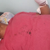 Individuo le corta mano a regidor PRM durante altercado