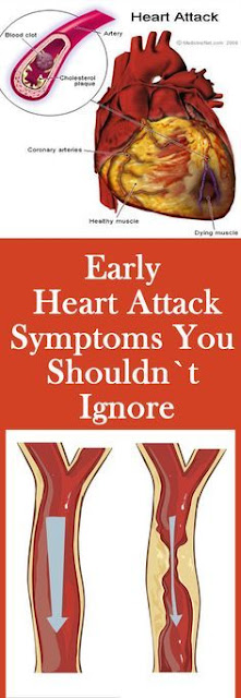 Early Heart Attack Symptoms You Shouldn`t Ignore